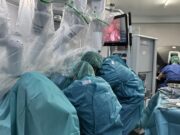 Tractament de l’endometriosi profunda amb cirurgia robòtica per preservar la fertilitat